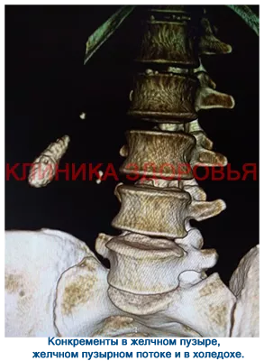 e1550f0172aee42835cebf540430eb1e.png