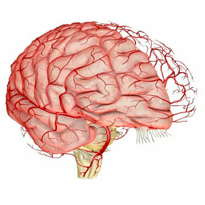 МРТ сосудов головного мозга