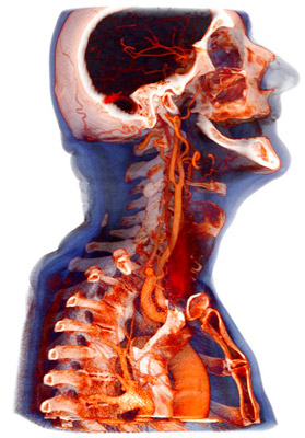 КТ органов шеи с контрастом